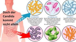 Candida  unklare Symptome bei Hefepilzbesiedlungen [upl. by Sufur]