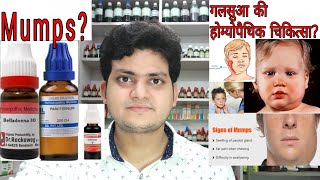 Mumps गलसुआ Homeopathic medicine for Mumps Explain [upl. by Caasi]