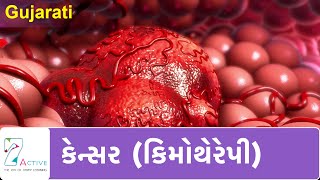 કેન્સર  કીમોથેરાપી   Cancer Chemotherapy  Gujarati [upl. by Anilehs]