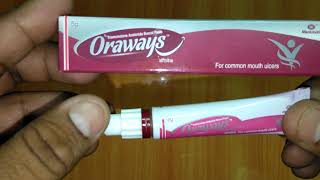 Oraways Buccal Paste review मुंह के छाले अलसर के लक्षण कारण उपचार [upl. by Nylavad984]