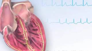 Afib Aflutter Junctional Arrhythmias  ECG EKG Interpretation Part 4 [upl. by Yralam]