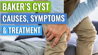 Baker’s Cyst Causes Symptoms Treatment Conservative vs Surgery [upl. by Everard]