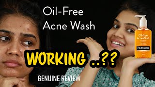 Neutrogena Face Wash Honest Review  Oil Free Acne Wash  NON SPONSORED [upl. by Magda854]