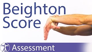 The Beighton Score  Generalized Joint Hypermobility Laxity [upl. by Ghiselin]