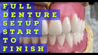 Full Denture Setup From Start To Finish [upl. by Deden401]