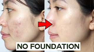 How to Cover Acne amp Blemishes WITHOUT Foundation • easy amp non cakey [upl. by Eseuqram]