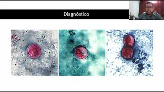 20 Cyclospora cayetanensis [upl. by Eronel]