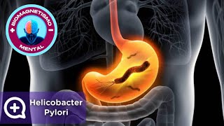 Helicobacter Pylori [upl. by Noreik]