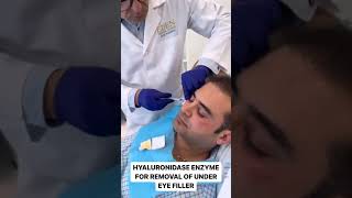 Hyaluronidase Enzyme for UnderEye Filler Removal  EDEN AESTHETICS Clinic Dubai [upl. by Revlys]