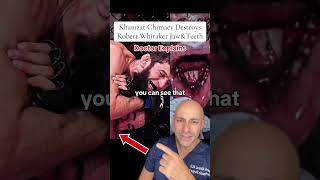 Khamzat Chimaev DESTROYS Robert Whitaker Jaw amp Teeth  Doctor Explains [upl. by Ylloj]