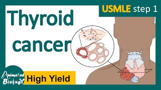 Thyroid cancer  Papillary Follicular Medullary amp Anaplastic  Symptoms Diagnosis Treatment [upl. by Ackler869]