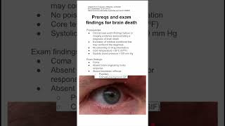 Prereqs and exam findings for brain death [upl. by Tavey]