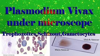 Plasmodium Vivax under microscope TrophozoitesSchizontGametocytesclear explain [upl. by Latrena564]