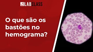 O que são os bastões no hemograma [upl. by Ynneb]