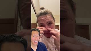 Plastic Surgeon Reacts to DIY Gelatin Face Mask [upl. by Sullecram]