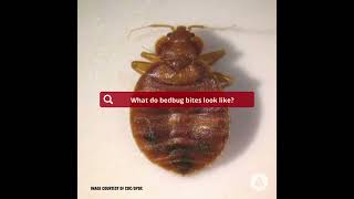 What Do Bedbug Bites Look Like [upl. by Supmart]