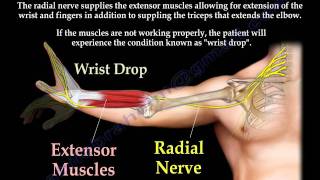 Radial Nerve Palsy injury  WRIST DROP  Everything You Need To Know  Dr Nabil Ebraheim [upl. by Eimile]