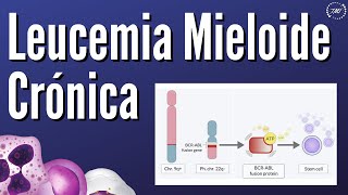 Leucemia Linfoide Aguda Explicada Claramente [upl. by Neidhardt]