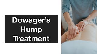 Dowagers Hump Treatment [upl. by Heise]