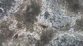 Video of beating cardiomyocytes [upl. by Ranger]