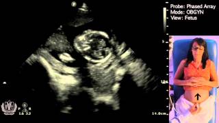 Obstetric Ultrasound Basics with Fetal Heart Rate Calculation​  Made Simple [upl. by Aneelak]