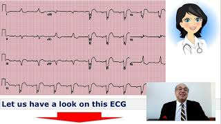 EKG Trainer Case 3 Questions [upl. by Attaynek]