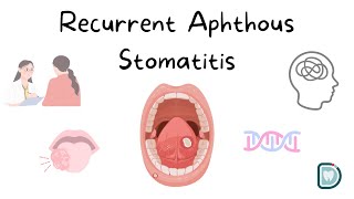 Understanding Recurrent Aphthous Stomatitis RAS or Oral Aphthous Ulcers [upl. by Osmond]