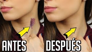 COMO QUITAR UN CHUPETON DEL CUELLO  TRUCOS DE MAQUILLAJE  LAURA MEJIA [upl. by Goodrow238]