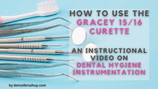 How to use the Gracey 1516 Curette [upl. by Ornstead]