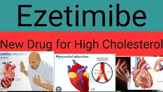 Ezetimibe Newer Drug for High Cholesterol levels [upl. by Law]