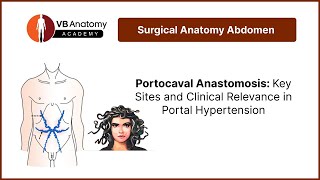 Portocaval Anastomosis Key Sites and Clinical Relevance in Portal Hypertension [upl. by Melodie]