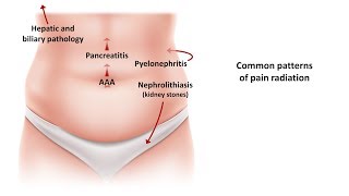 An Approach to Acute Abdominal Pain [upl. by Maher232]