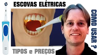 Escovas de Dente Elétricas São Boas Tipos Preços e Como Usar [upl. by Moselle]