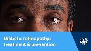 The Ophthalmic Exam Retina and Posterior Segment [upl. by Eglantine348]