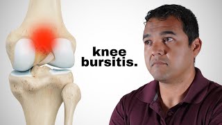 Knee Bursitis Causes Symptoms and Treatment Options [upl. by Cherian]