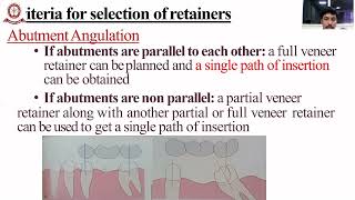 Parts of Fixed Partial Denture [upl. by Silera]