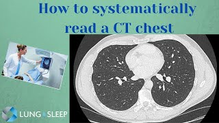 How to systematically read a CT chest [upl. by Toor410]