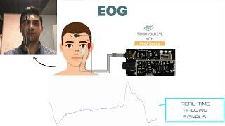 Electroencephalography EEG Explained  Neuroscience Methods 101 [upl. by Ihcalam295]