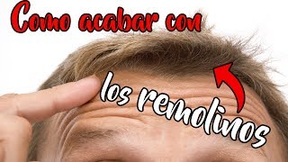 COMO ACABAR CON LO REMOLINOS Y CAMBIAR DIRECCIÓN DEL PELO [upl. by Algie996]