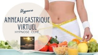 ANNEAU GASTRIQUE virtuel [upl. by Tristam]