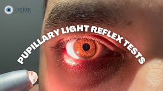 Pupillary Light Reflex Tests [upl. by Ardnikat]