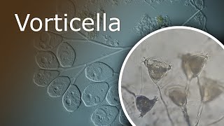 All About Vorticella Description History and Habitat Vorticella Under a Microscope 100x1000x [upl. by Liagibba]