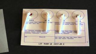 How To Test Your Blood Type At Home EASY amp UNDER 10 [upl. by Lidah483]