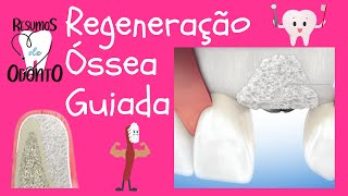 Regeneração óssea guiada  Resumos de Odonto [upl. by Tillford]