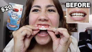 I tried INSTANT VENEERS to see if they actually worked [upl. by Baker378]