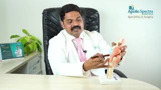 What is Ligament injury  Dr Illavarsan [upl. by Millicent]