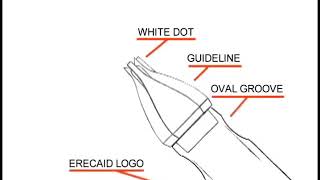 Osbon Erecaid Instructions [upl. by Korey]