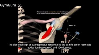 Shoulder impingement syndrome GymGuruTV [upl. by Thomey884]