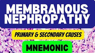 Tema 5  Glomerulopatia membranosa [upl. by Adhamh]