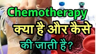 Chemotherapy l Cancer l Therapy l क्या होती है  । [upl. by Refitsirhc]